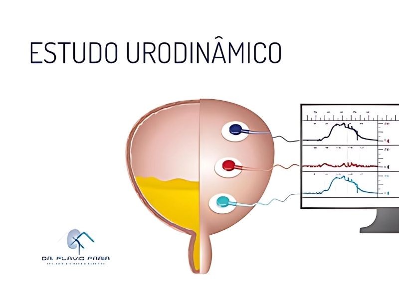 Tudo o que você precisa saber sobre o Estudo Urodinâmico