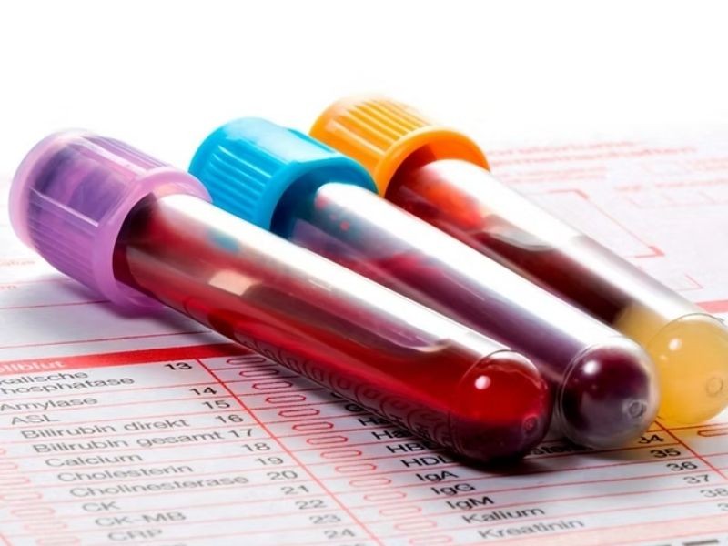 Saiba qual o exame que detecta o câncer de próstata com 94% de precisão