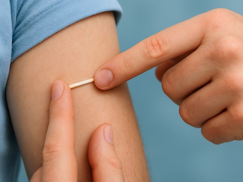 Implantes Hormonais Masculinos