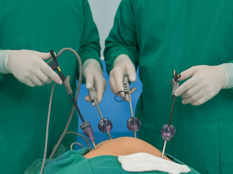 Laparoscopia